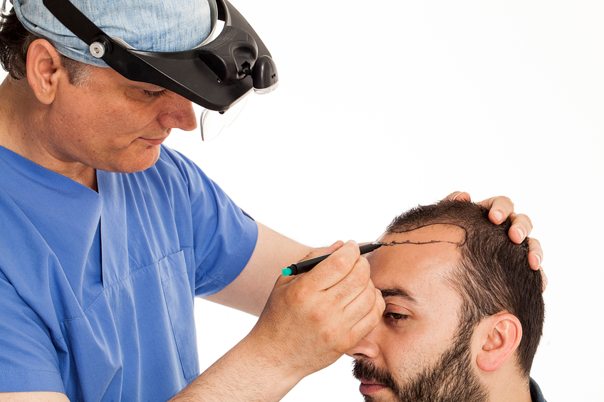 hair transplant doctor