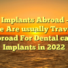 Teeth Implants Abroad — Why People Are usually Travelling abroad For Dental care Implants in 2022